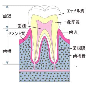 歯周病